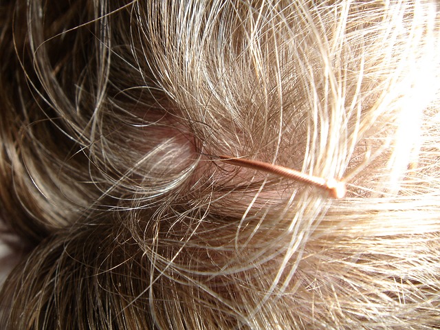 Kopfhautjucken und stressbedingter Haarausfall